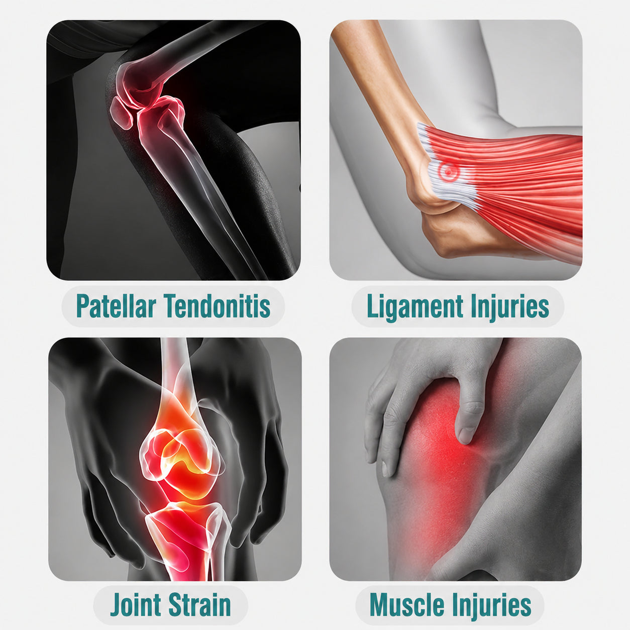 Illustration av vanliga knäbesvär som patellarsenetendinit, ligamentskador, ledsmärta och muskelbesvär.