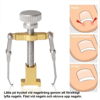 Verktyg mot nageltrång